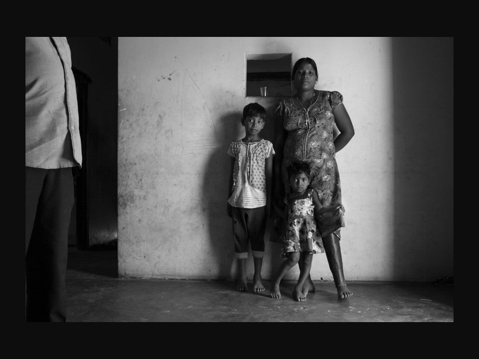 A woman with a prosthesis following the civil war in Sri Lanka